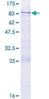 Human GMCL1 Protein (Recombinant GST)