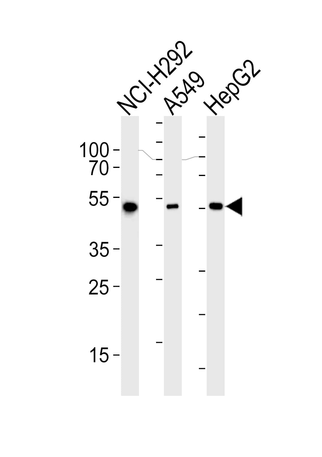 ALDH2 Antibody