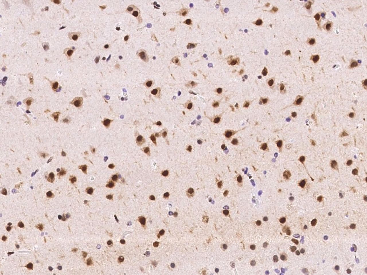 Polyclonal Rabbit anti-Human ZSCAN18 / ZNF447 Antibody (IHC)