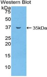 SMPD1 / Acid Sphingomyelinase Antibody (aa319-579)