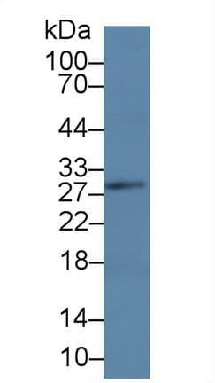 LAT Antibody (aa25-221)