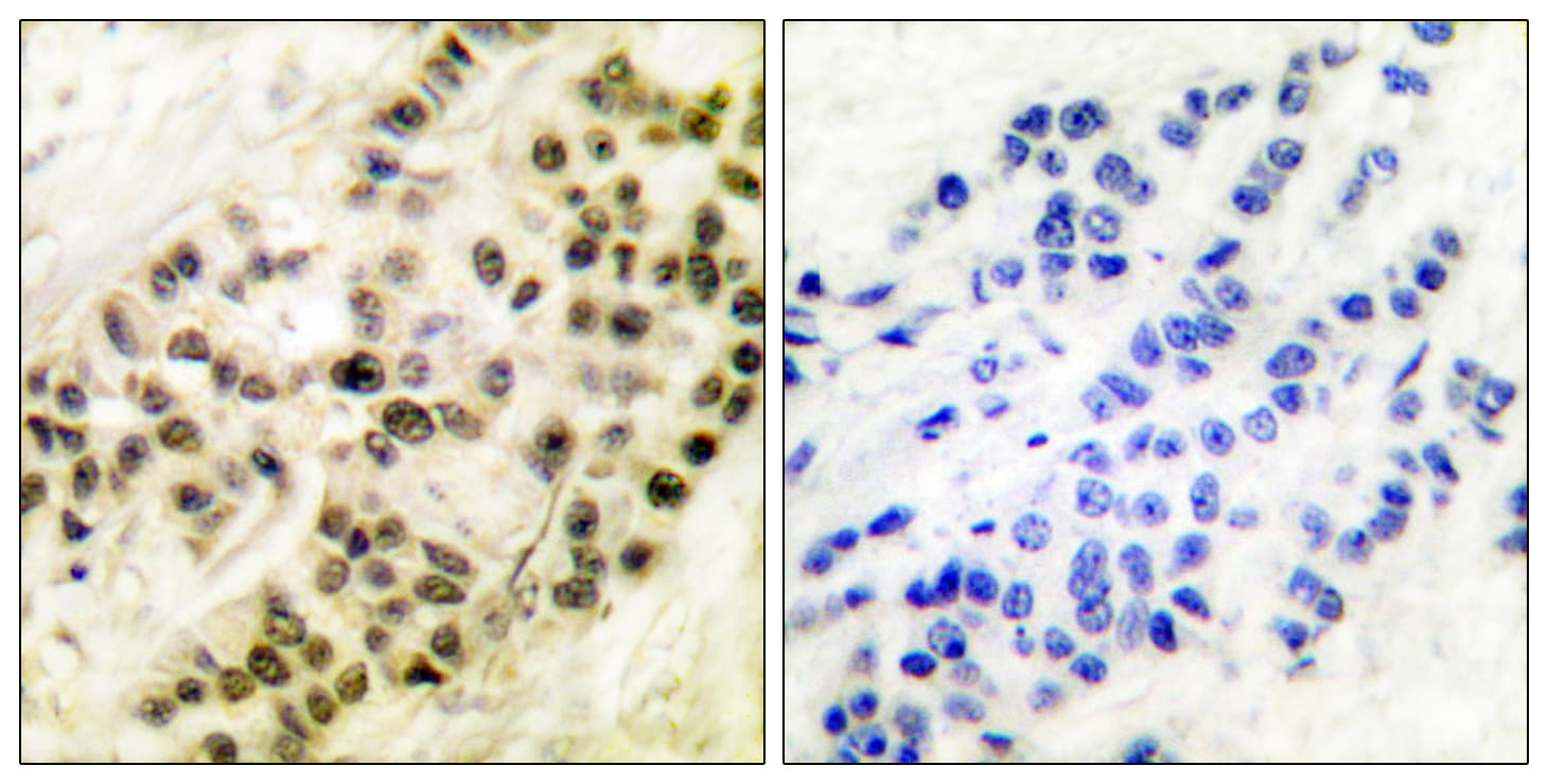 CCNB1 / Cyclin B1 Antibody (aa91-140)