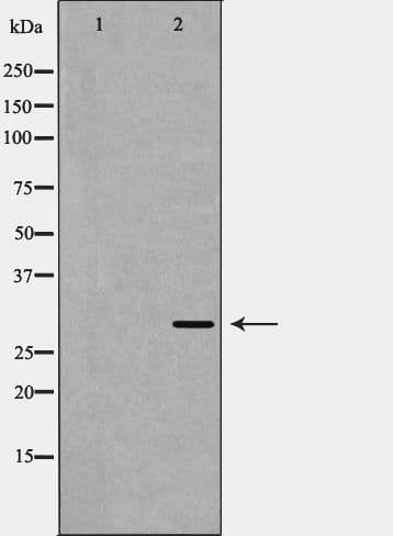 AQP1 / Aquaporin 1 Antibody