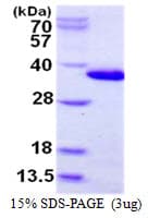 Human CHMP6 Protein (Recombinant His)