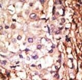 PRMT6 Antibody (aa19-48)