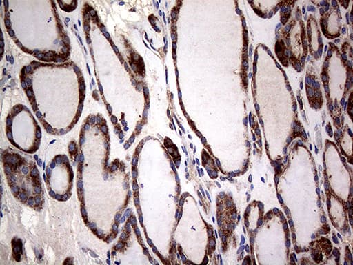 CTSL / Cathepsin L Antibody (clone OTI2F1)
