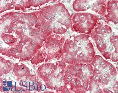 IHC-plus™ Polyclonal Rabbit anti-Human CRELD2 Antibody (IHC, WB)