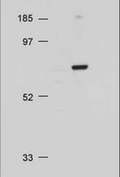 IHC-plus™ AKT1 + AKT2 + AKT3 Antibody (aa460-480)