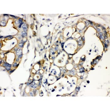 Polyclonal Rabbit anti-Human PLEC / Plectin Antibody (aa2644-2671, IHC, WB)