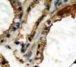 TG / Thyroglobulin Antibody