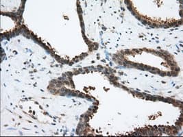 ACAT2 Antibody (clone OTI3E2)