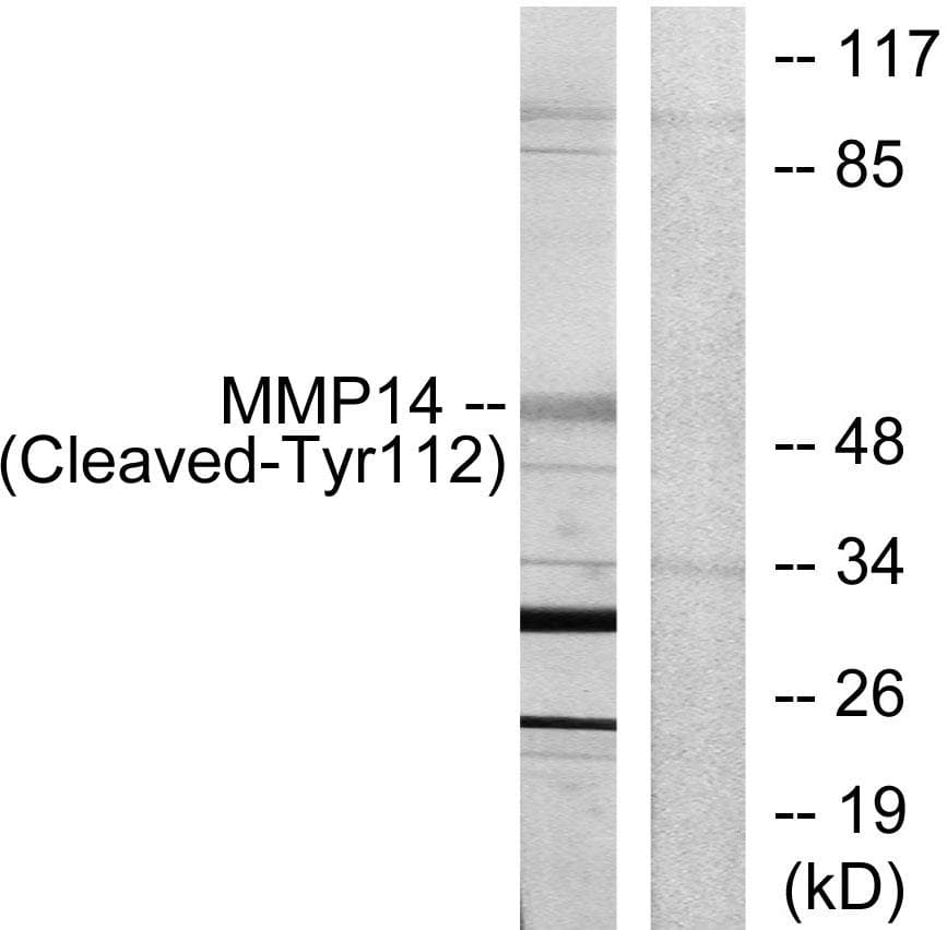 Polyclonal Rabbit anti-Human MMP14 Antibody (Cleaved-Tyr112, WB)