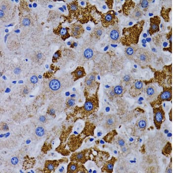 CYP24 / CYP24A1 Antibody