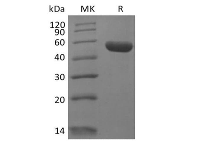 Human LAIR2 / CD306 Protein (Recombinant Fc, C-terminus)