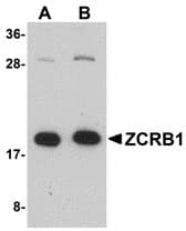 IHC-plus™ Polyclonal Rabbit anti-Human ZCRB1 Antibody (IHC, WB)