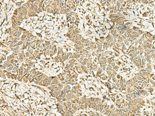 MYST2 / HBO1 Antibody