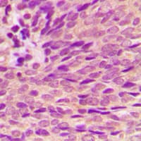 ER Alpha / Estrogen Receptor Antibody (phospho-Ser118)