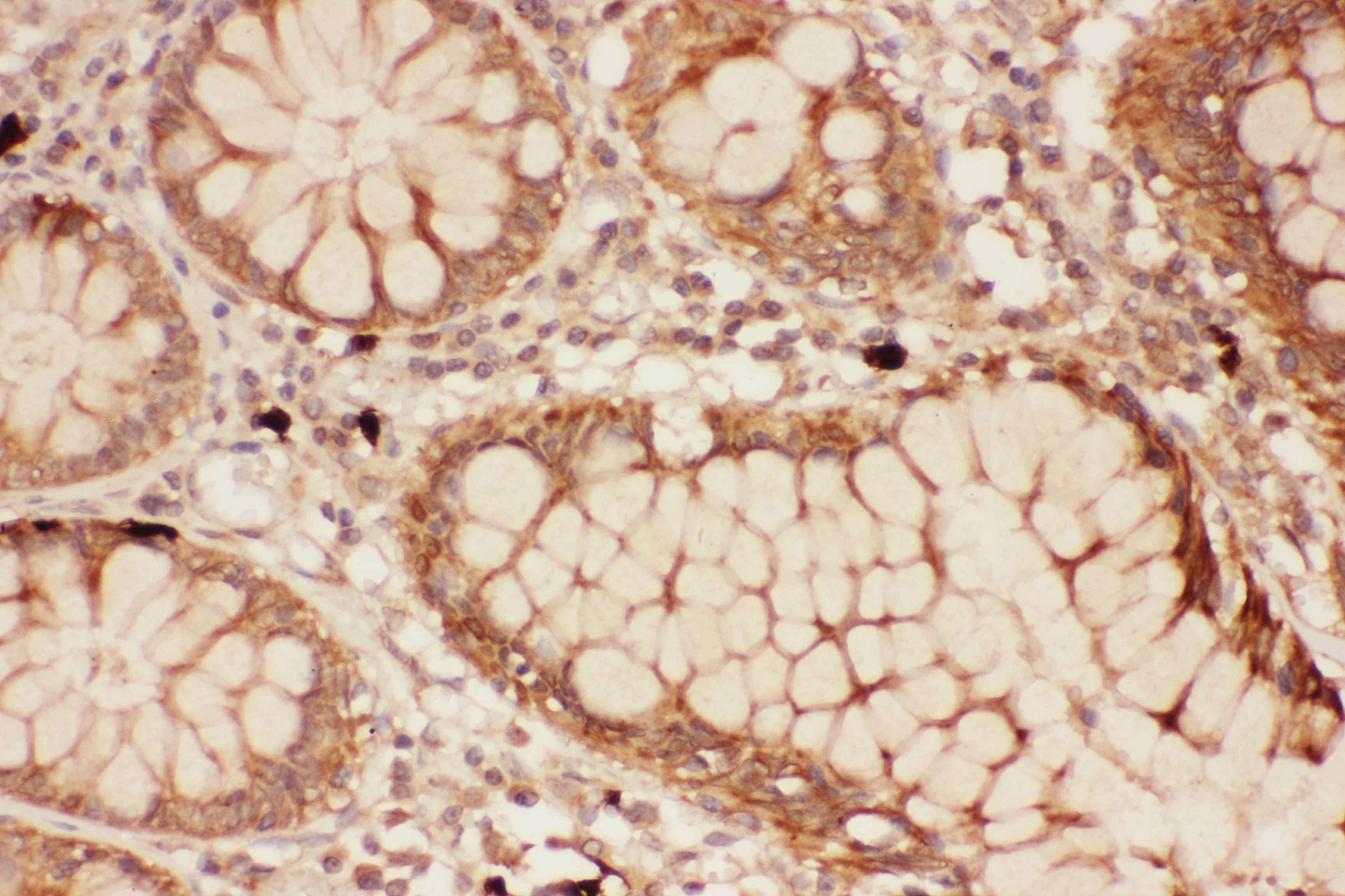 Polyclonal Rabbit anti-Human ALOX15 / 15-Lipoxygenase Antibody (aa2-337, IHC, WB)
