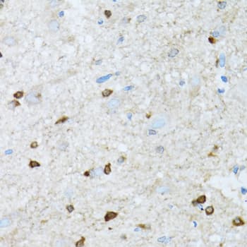 ROCK2 Antibody