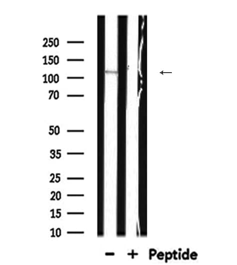Polyclonal Rabbit anti-Human GOLGA2 / GM130 Antibody (IHC, IF, WB)