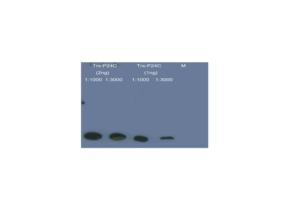 Thioredoxin / TRX Tag Antibody (aa1-111)