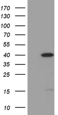 M-PST / STM Antibody (clone OTI1B6)