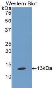 MUC5B Antibody (aa664-724, FITC)