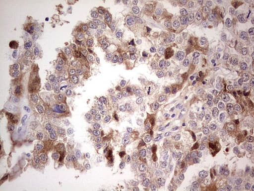 CFI / Complement Factor I Antibody (aa340-583, clone OTI7C9, Carrier-free)