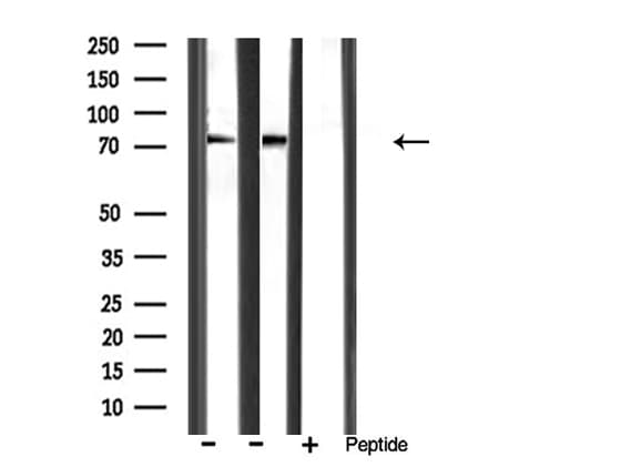 Polyclonal Rabbit anti-Human MMP9 / Gelatinase B Antibody (IHC, IF, WB)