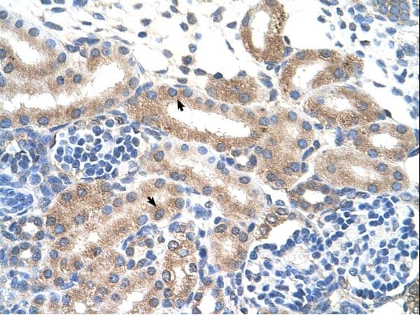Polyclonal Rabbit anti-Human FAM174B Antibody (N-Terminus, IHC, WB)