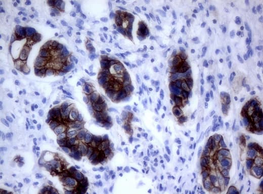 ERBB2 / HER2 Antibody (aa676-1255, clone UMAB35)