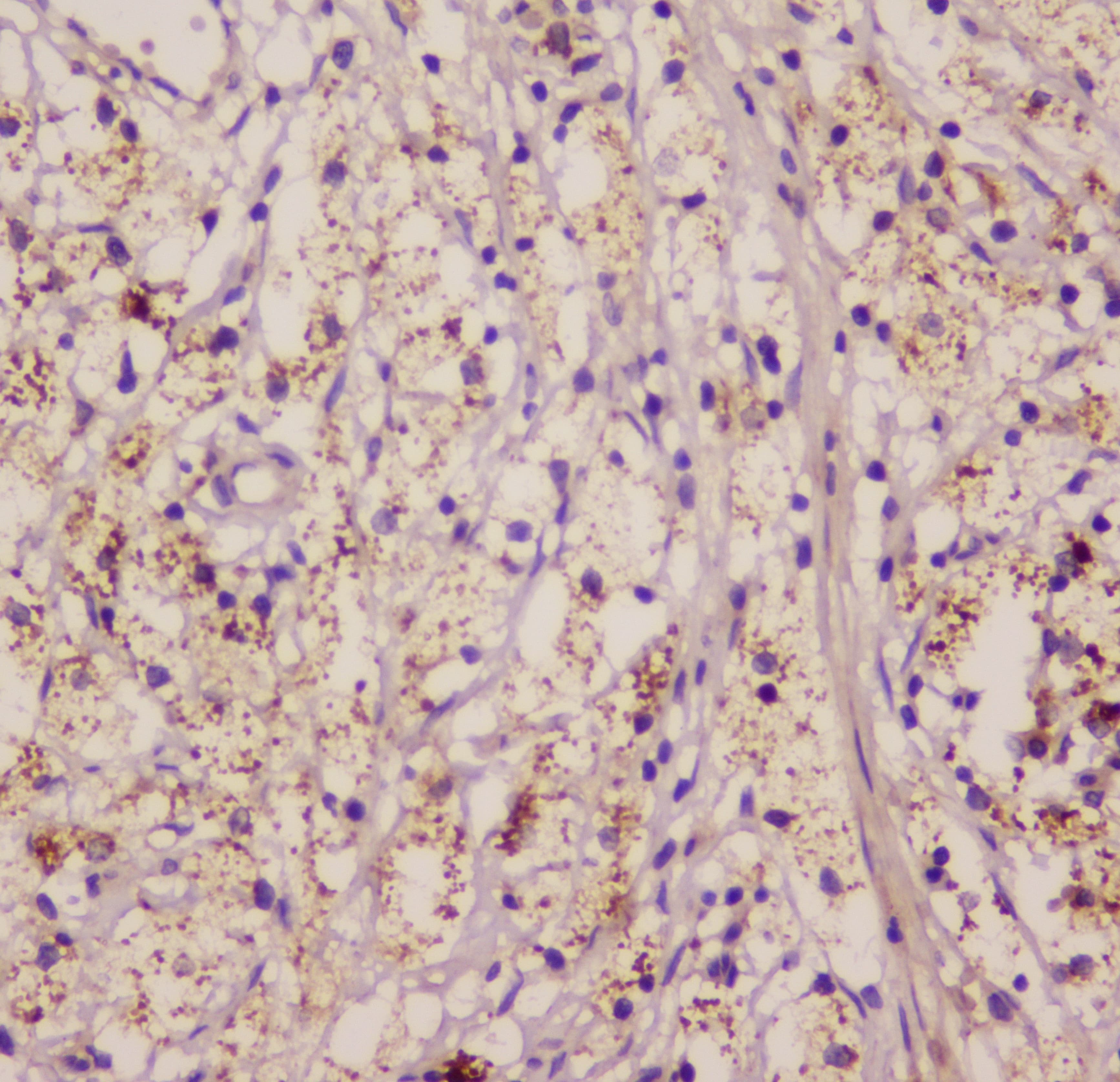 Polyclonal Rabbit anti-Human EML4 Antibody (IHC, WB)