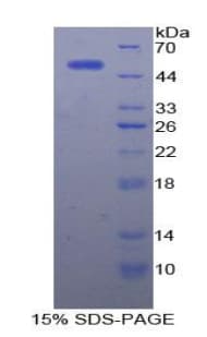Rat Alpha-Fetoprotein (Recombinant His-GST)