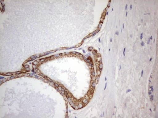 Monoclonal Rat anti-Human Acidic Cytokeratin Antibody (clone 2G10, IHC)