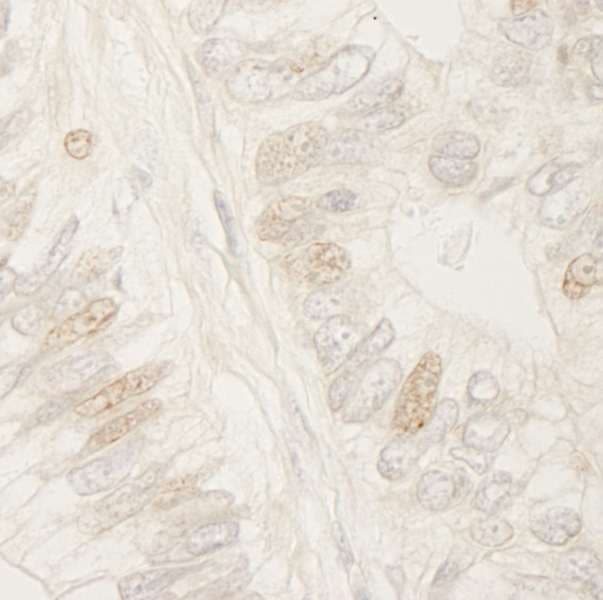 Polyclonal Rabbit anti-Human APC Antibody (aa75-125, IHC)