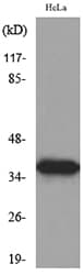 ANXA2 / Annexin A2 Antibody