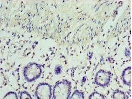 VIPERIN / RSAD2 Antibody (aa42-361)