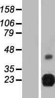 RTBDN / Retbindin Protein (Over-Expression Lysate Myc-DDK (Flag))
