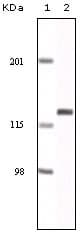 IHC-plus™ EPHA2 / EPH Receptor A2 Antibody (clone 1B3C7)