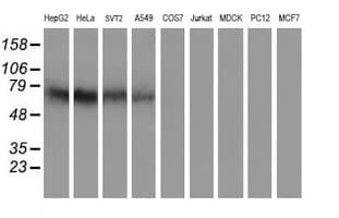 IDS / Iduronate 2 Sulfatase Antibody (clone OTI1D9)