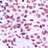 Polyclonal Rabbit anti-Human MZF / MZF1 Antibody (N-Terminus, IHC, IF, WB)