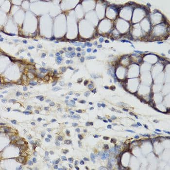 GHRL / Ghrelin Preproprotein Antibody