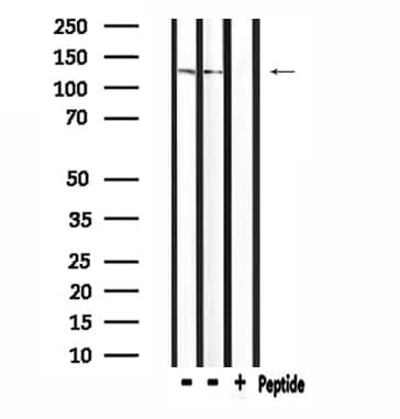 NCAN / Neurocan Antibody