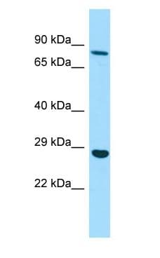 Polyclonal Rabbit anti-Human EMILIN3 Antibody (aa607-656, WB)