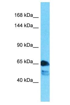 Polyclonal Rabbit anti-Human WC1 / ATP7B Antibody (aa201-250, WB)