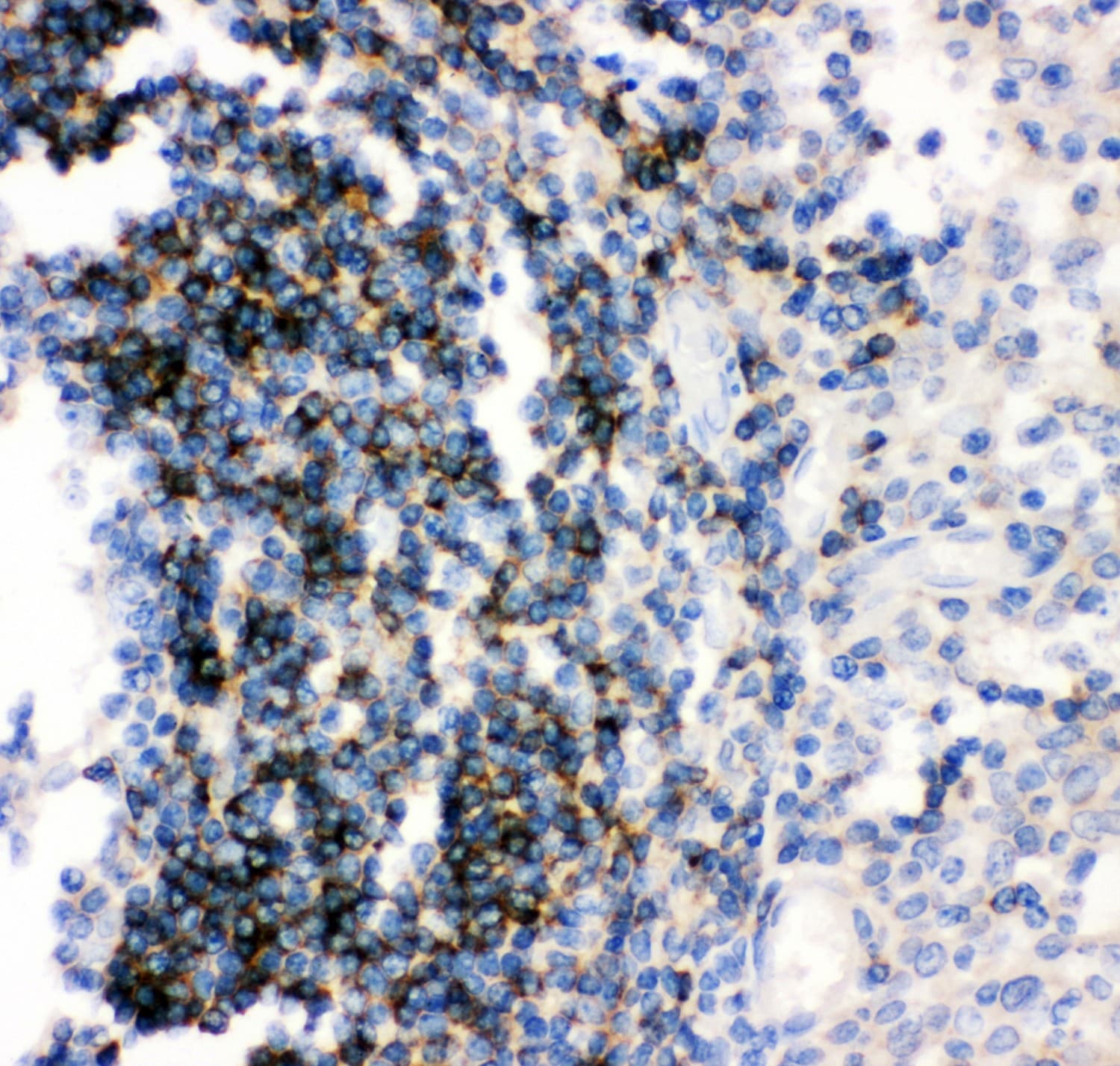CD79B / CD79 Beta Antibody (aa29-229)