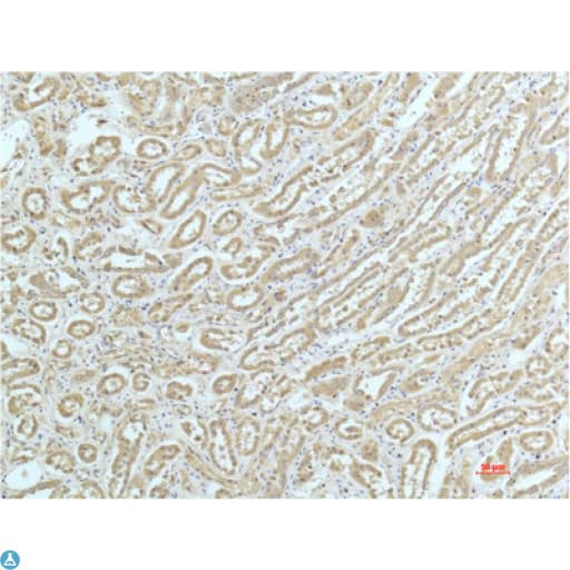 Alpha Actinin Antibody