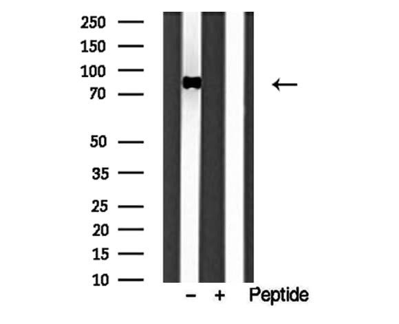 Polyclonal Rabbit anti-Human TG737 / IFT88 Antibody (IHC, WB)