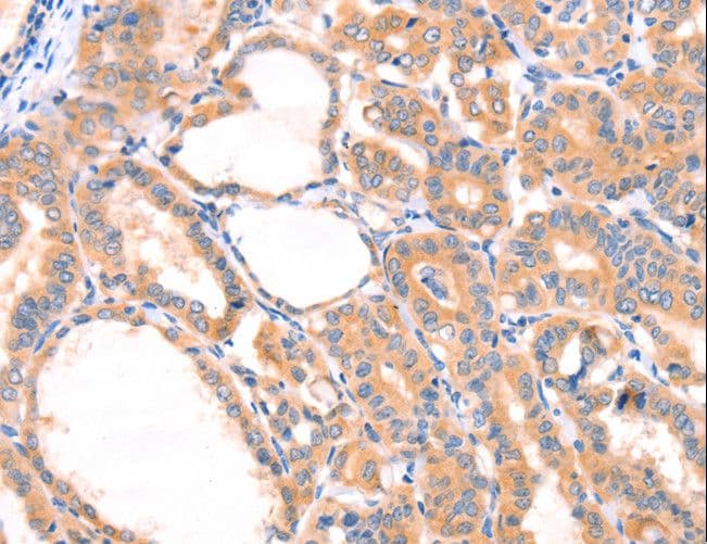 Polyclonal Rabbit anti-Human PRDX2 / Peroxiredoxin 2 Antibody (IHC, WB)