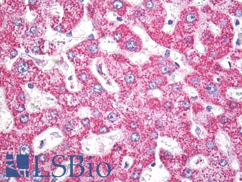 IHC-plus™ ALDH2 Antibody (aa318-347)